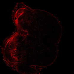 15PCW human midbrain